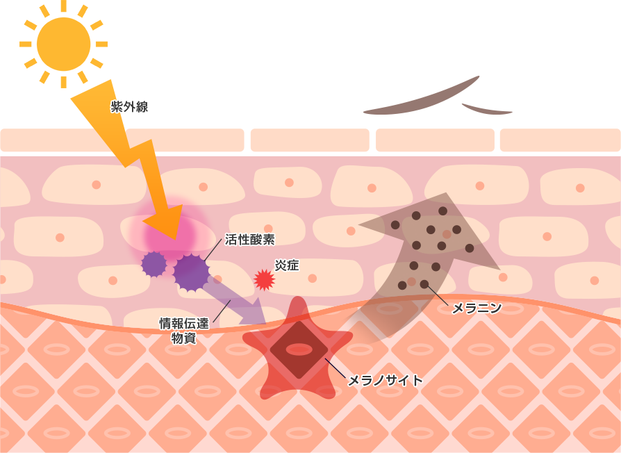 シミができるメカニズム